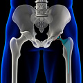 A 3D illustration of an artificial hip. A 3D illustration of an artificial hip.