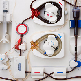 An example of a dialysis machine. An example of a dialysis machine.