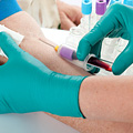 A patient having a blood sample collected. A patient having a blood sample collected.