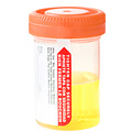 Un échantillon d'urine. Un échantillon d'urine.