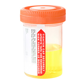 Un échantillon d'urine. Un échantillon d'urine.